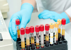 Qan analizi ilə xəstəlikləri 10 il əvvəldən aşkar etmək mümkün ola bilər