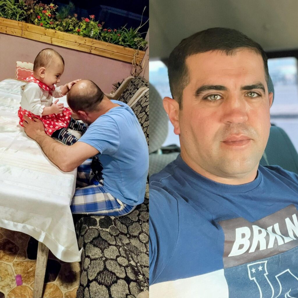 Keçəllikdən bu bitkinin köməyi ilə qurtuldu – FOTO