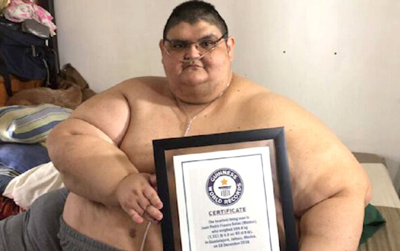 Dünyanın ən kök adamı öldü – FOTO