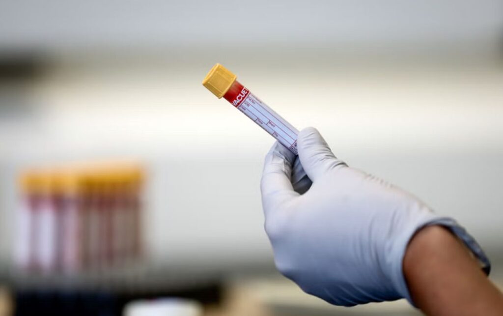 İdmançımız 2 illik diskvalifikasiya olundu