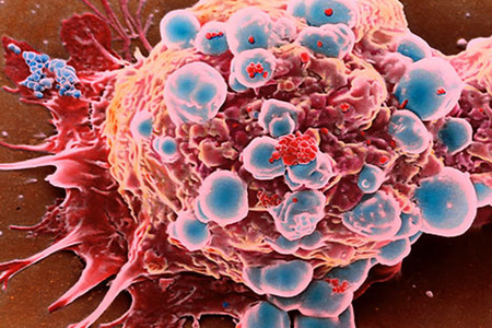 Xərçəng riskini azaltmaq üçün SADƏ VƏRDİŞLƏR